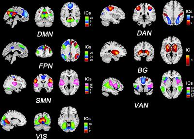 Male and female are not the same: a multicenter study of static and dynamic functional connectivity in relapse-remitting multiple sclerosis in China